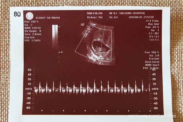 【懷孕日記．12週~20週】我要當媽了。懷孕前三個月 / 懷孕第一次產檢 / 妊娠霜的選購 / 脊髓性肌肉萎縮症檢測 / 羊膜穿刺糖氏症篩檢 / 染色體基因檢測 / 月子中心挑選 @飛天璇的口袋